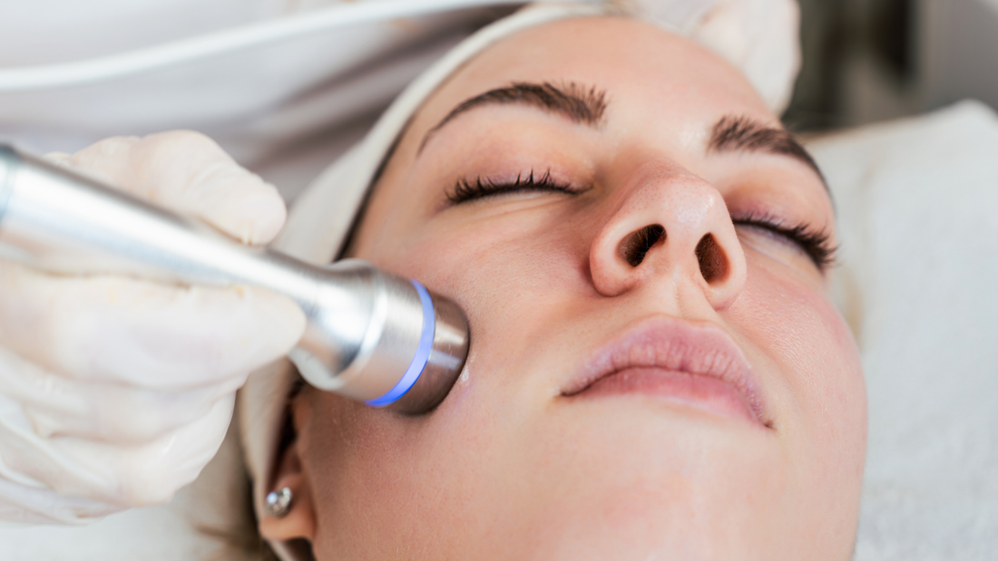 Microdermabrasion + Radiofrequency