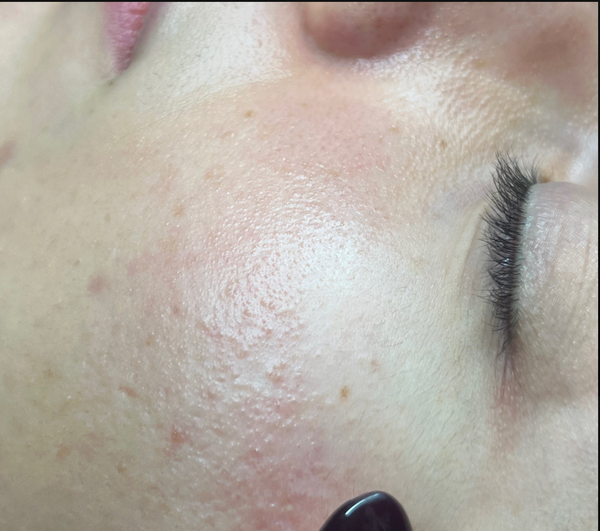 Before