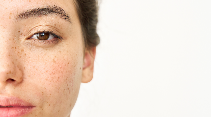 Reveal your best skin