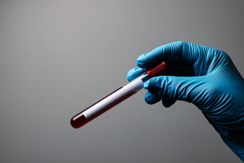 BLOOD WORK